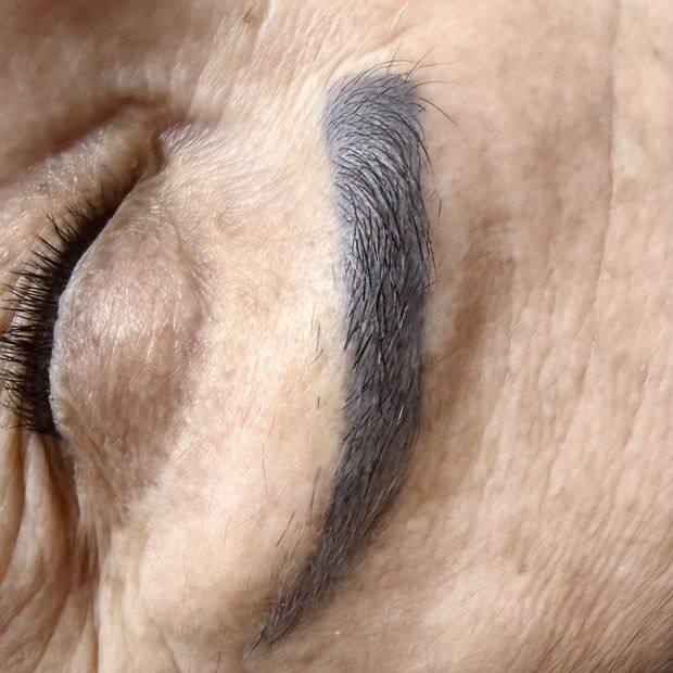 Sobrancelha com micropigmentação escura, antes do tratamento